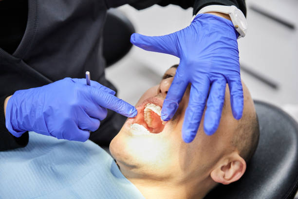 Best Emergency Dental Care for Broken or Chipped Teeth in Middleton, WI